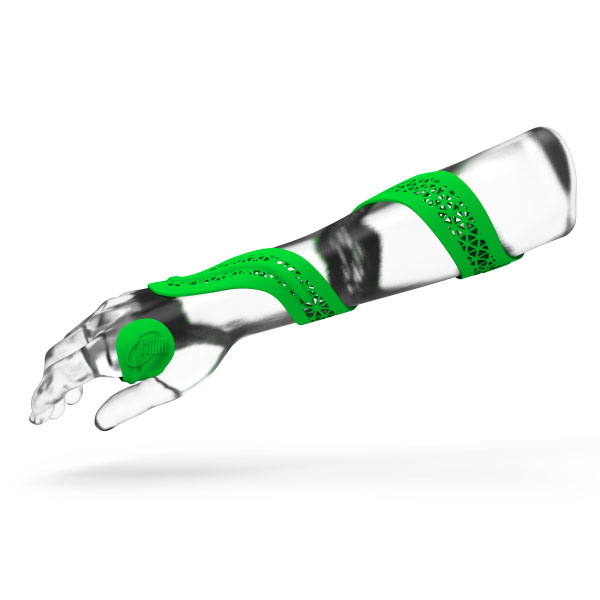 rios® Spiralhandorthese von rahm zur Behandlung von Muskelerkrankungen