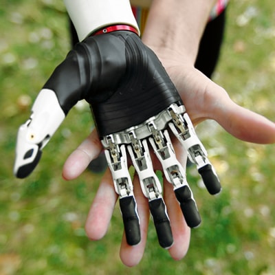 rahm_Amputation_Prothese_Testversorgung_Bebionic-min BeBionic Prothesenhand testen bei rahm in Köln, Bonn, Leverkusen, Koblenz, Troisdorf