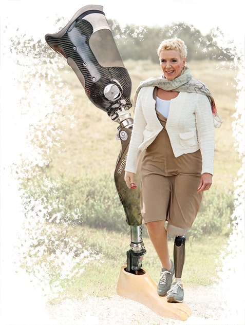 Orthopädietechnik Armprothesen Beinprothesen vom Sanitätshaus rahm innovative Prothesenversorgung
