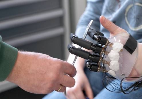 Neue Möglichkeiten mit Teilhandprothese